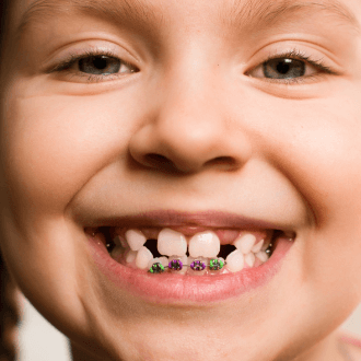 Closeup ofchild with pediatric orthodontics