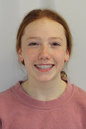 Young girl with beautiful smile after orthodontics