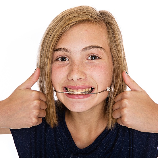 Young woman with headgear orthodontic appliance