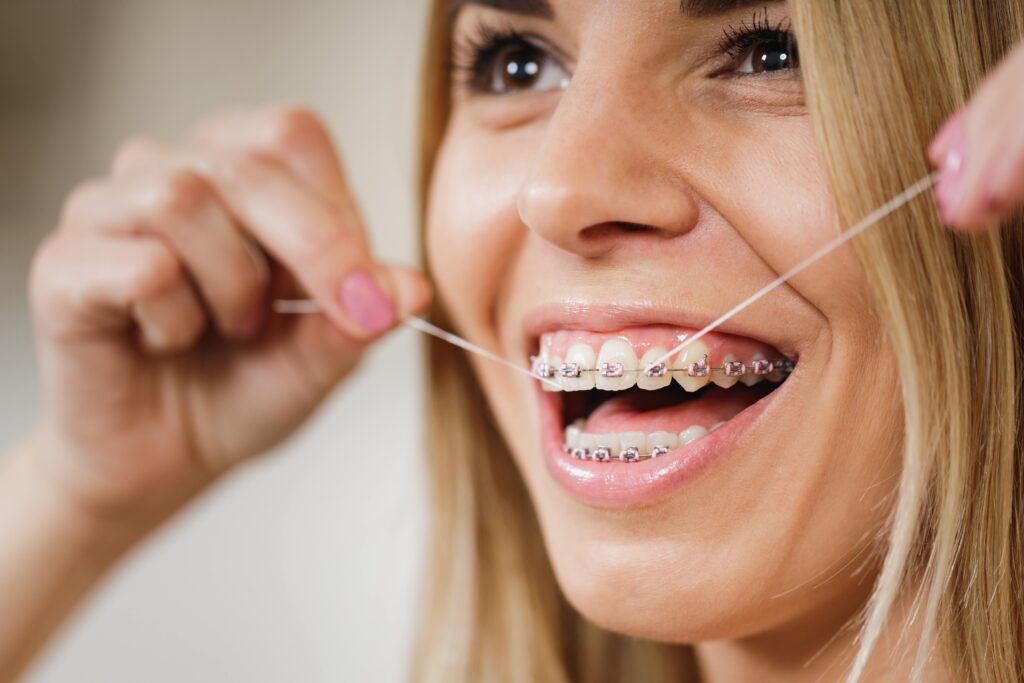 Woman smiling while flossing with braces